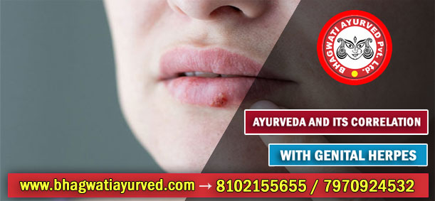 Ayurveda and Its Correlation with Genital Herpes