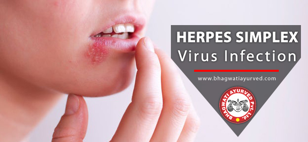 Best Treatment for Herpes