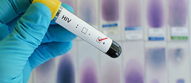 HIV Ayurveda Treatment Center