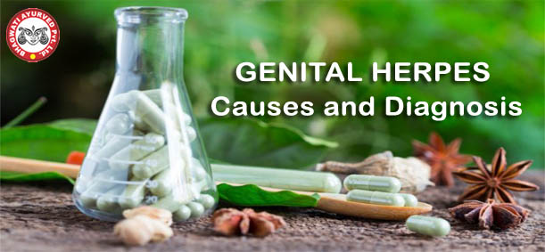 Causes of Genital Herpes