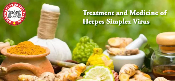 Treatment and Medicine of Herpes Simplex Virus