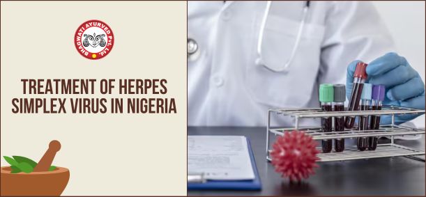 Treatment of Herpes Simplex Virus in Nigeria