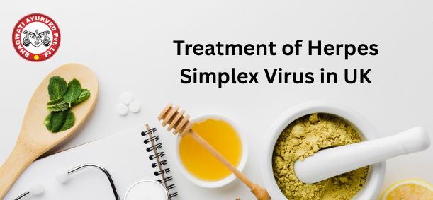 Treatment of Herpes Simplex Virus in UK